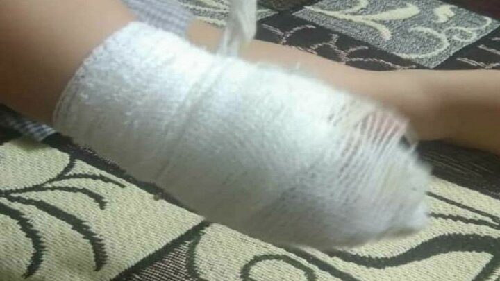 ماجرای تلخ پاسمان دست نوزاد قمی و بد رفتاری کادر درمان بیمارستان فرقانی چه بود؟