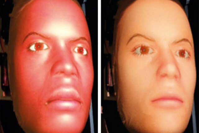 ساخت رباتهای دارای حس درد برای آموزش پزشکان